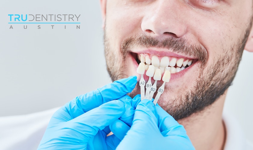 Dental Veneers Austin - Dentist in Austin TX 78704 - TRU Dentistry Austin