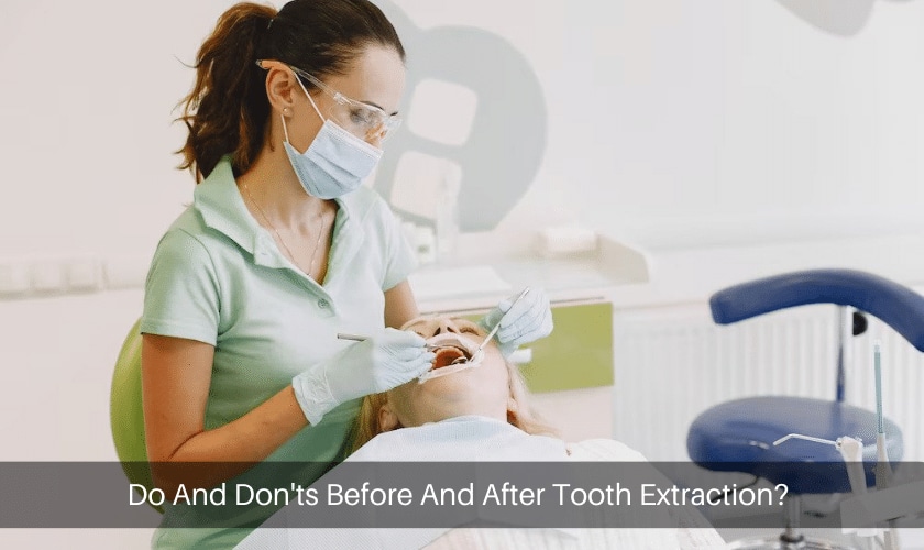 Do And Don’ts Before And After Tooth Extraction