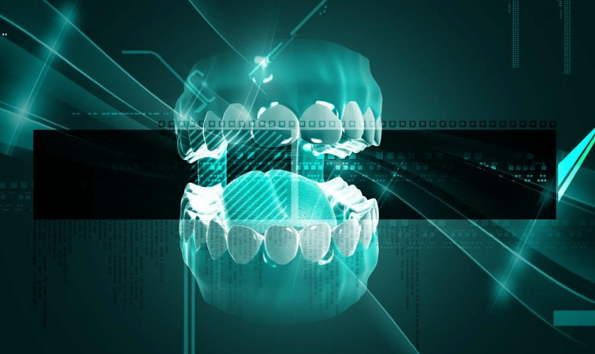 Image of Dental Implant - Innovations In Dental Implant Technology: What's New And Effective