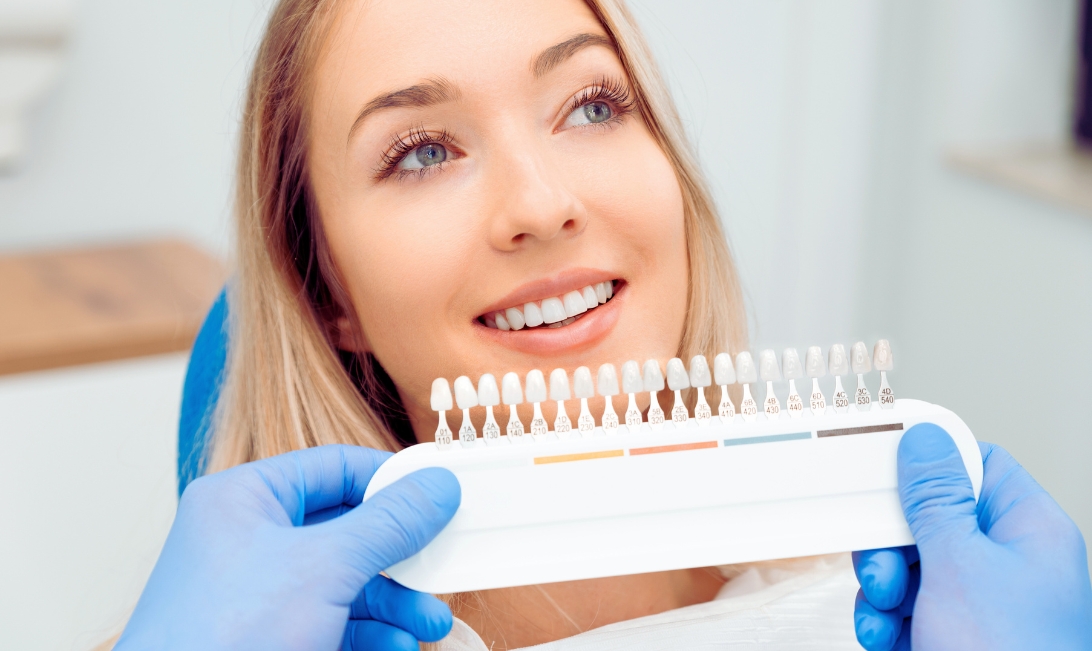are veneers the right solution for your chipped or stained teeth