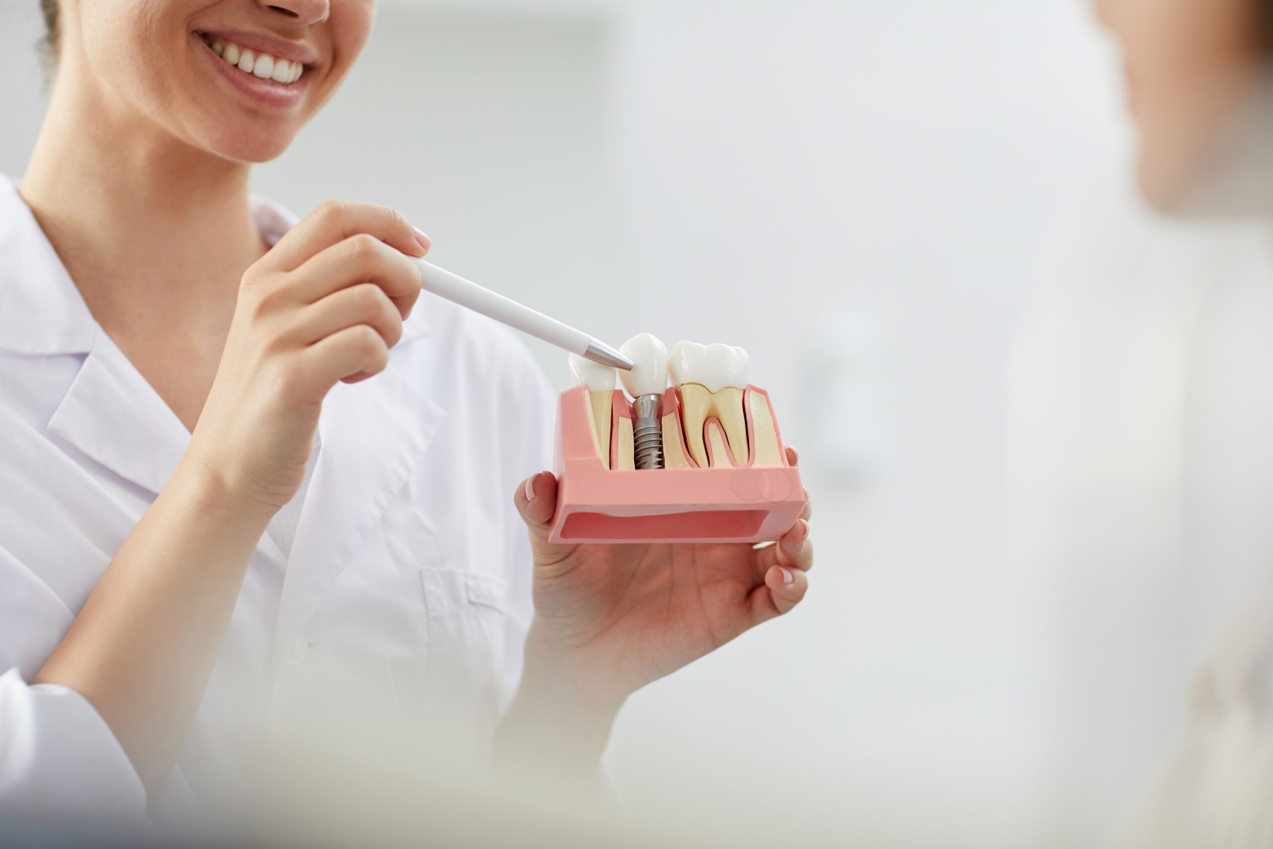 Dental Implants in