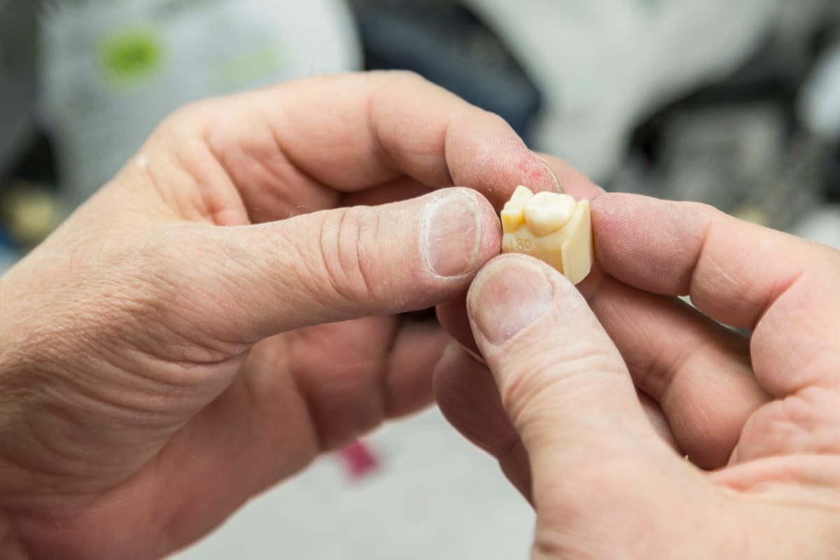 Dental Crowns in Austin