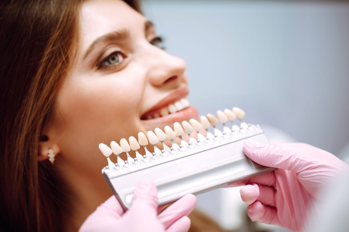 Veneers in Austin